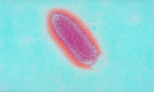 Hình ảnh hiển vi của virus gây bệnh dại (Rabdoviridae). Ảnh: Sanofi Pasteur/Flickr.