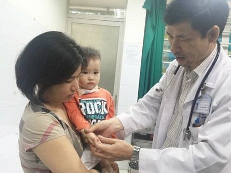  Một em bé bị tay chân miệng đi khám tại Bệnh viện Nhi Trung ương.