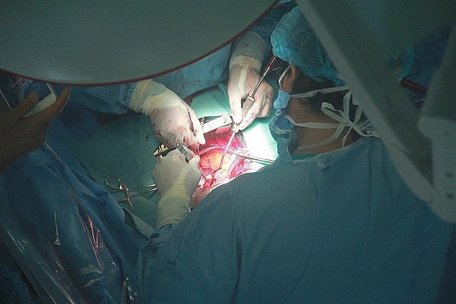  Các bác sĩ Bệnh viện Trung ương Huế đang phẫu thuật ghép tim