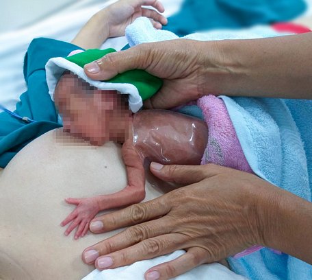 Bé Bắp sinh non ở tuần thứ 26, sau 2 tuần đã tự bú sữa mẹ